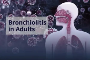 Bronchiolitis in Adults The Hidden Cause Behind Your Persistent Cough- featured image